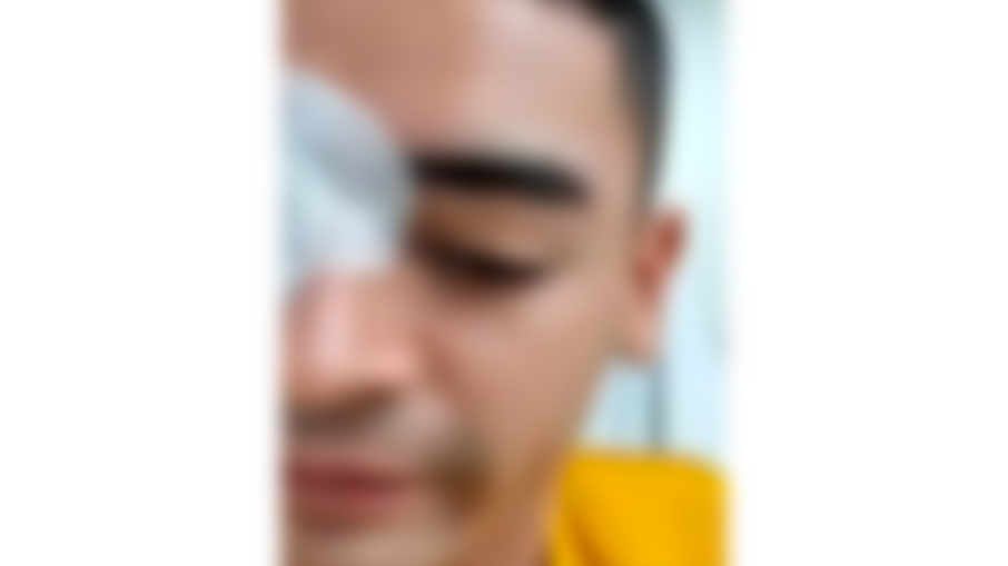 Lesionado permanente