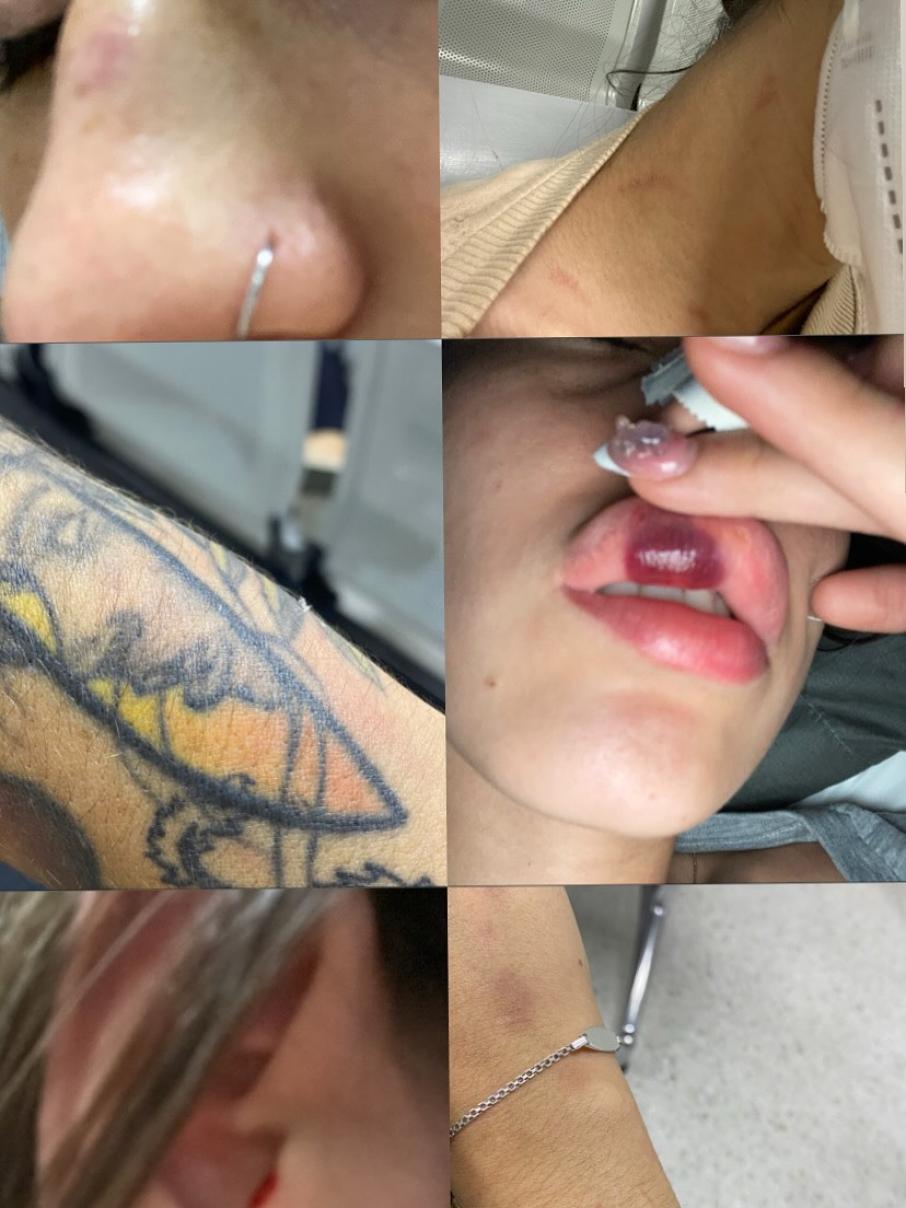 Pruebas compartidas a través de sus redes sociales.  