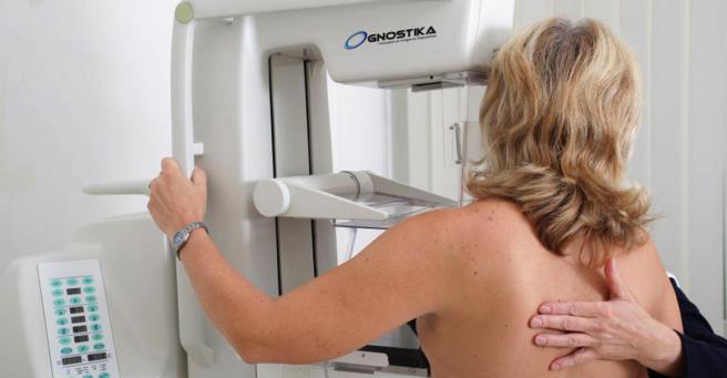 Hay que desmontar los mitos que existen sobre la maografía.