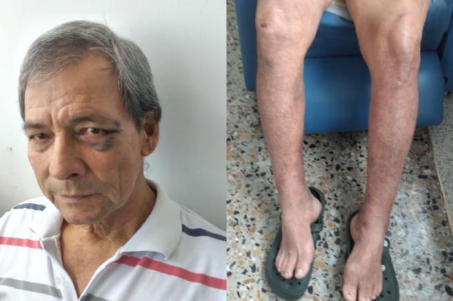 La mujer hace el llamado a la EPS.